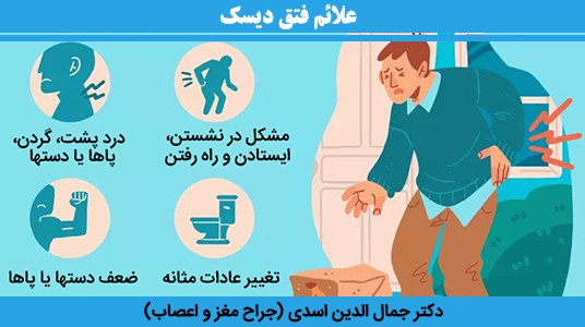 علائم-فتق-دیسک