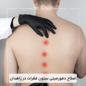 اصلاح-دفورمیتی-ستون-فقرات-در-زاهدان