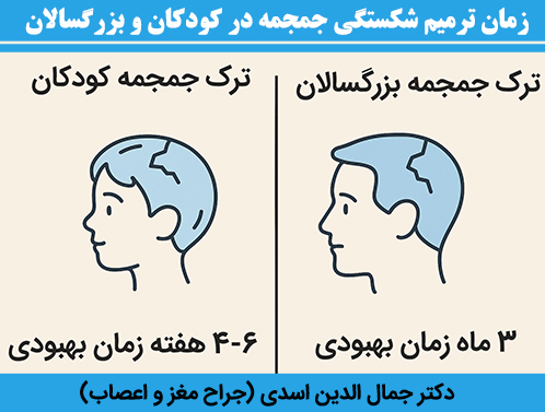 زمان-ترمیم-شکستگی-جمجمه-در-کودکان-و-بزرگسالان