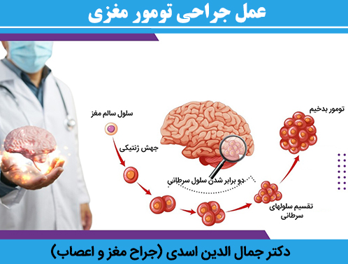 عمل-جراحی-تومور-مغزی