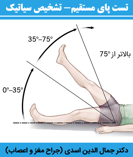تست-پای-مستقیم--تشخیص-سیاتیک