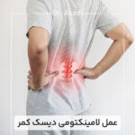 عمل-لامینکتومی-دیسک-کمر